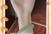 手环侧面脱色怎么处理？有哪些修复方法？