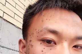 复印机皱纹问题的修理方法（探索复印机皱纹问题的原因与解决办法）