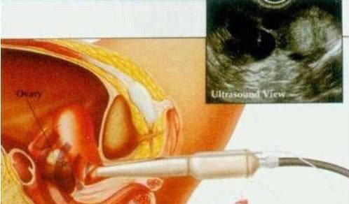 增加生双胞胎几率的方法（科学策略和健康调整）  第1张