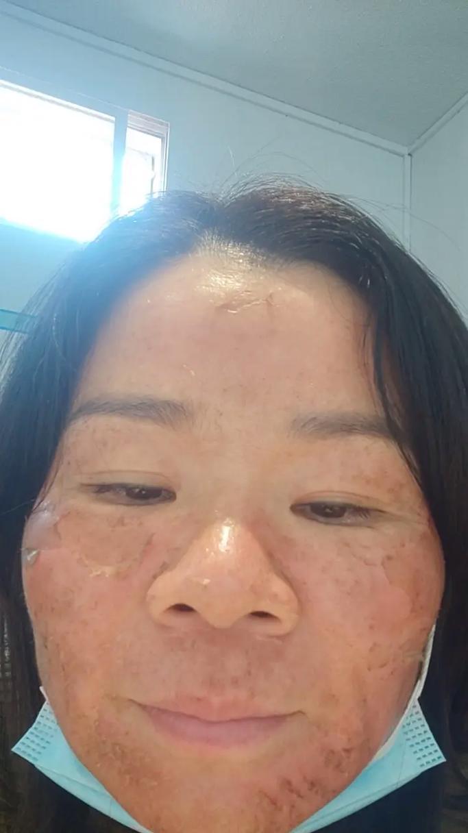 皆原相机无美颜功能的解决方法是什么？  第3张